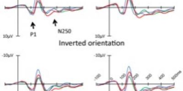 Article teaser image