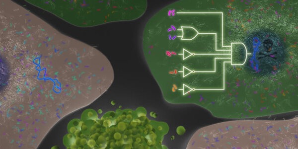 Article teaser image