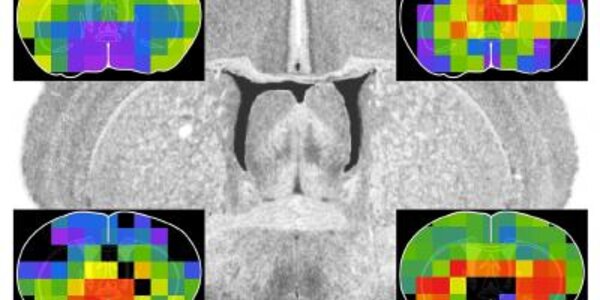 Article teaser image