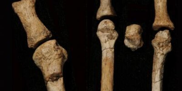 Article teaser image