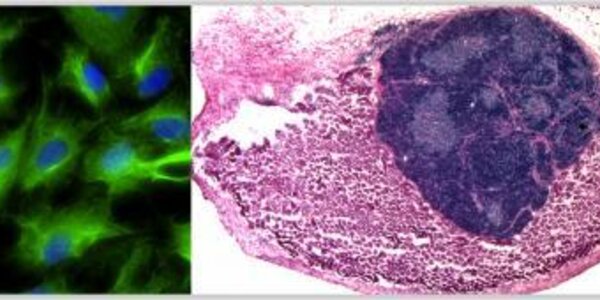 Article teaser image