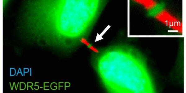 Article teaser image