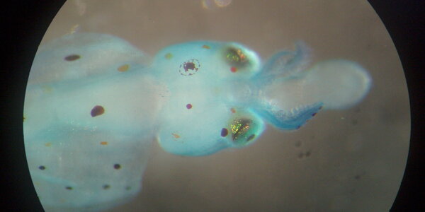 Article teaser image