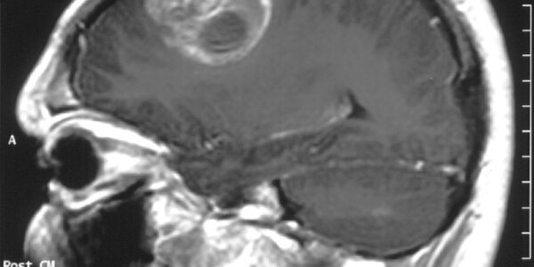 Article teaser image