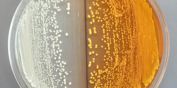 Article teaser image