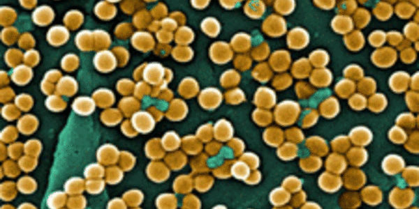 Article teaser image