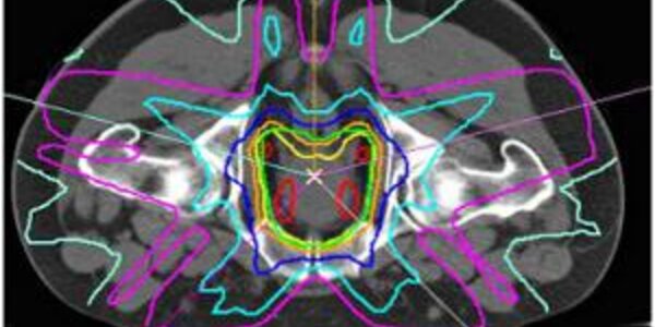 Article teaser image