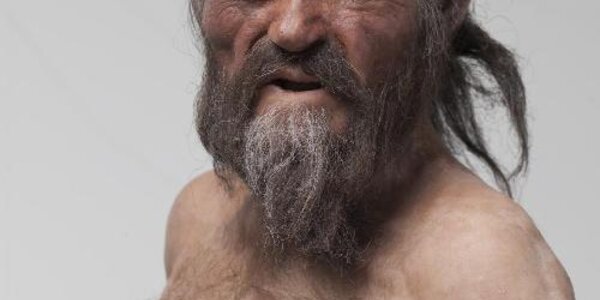 Article teaser image