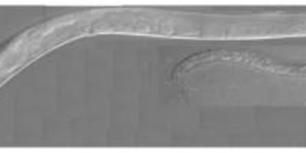 Article teaser image