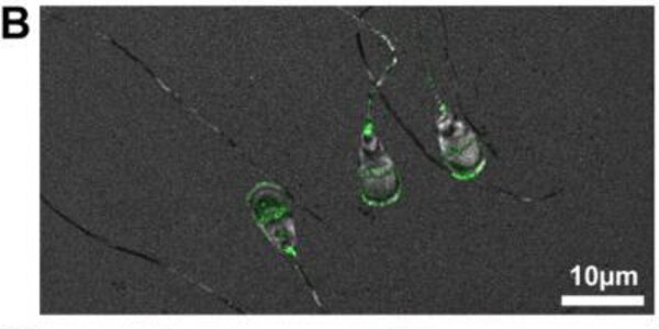 Article teaser image