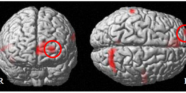 Article teaser image