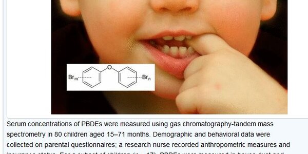 Article teaser image