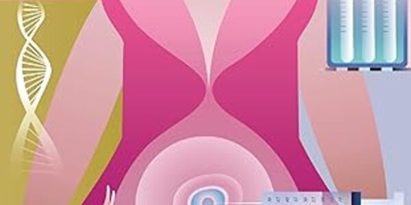 Article teaser image