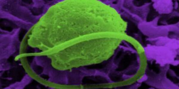 Article teaser image