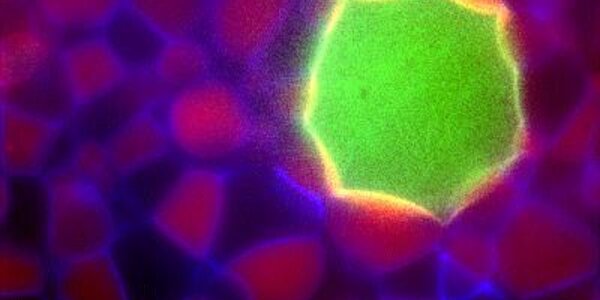 Article teaser image