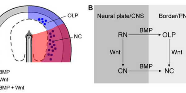 Article teaser image