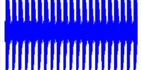 Article teaser image