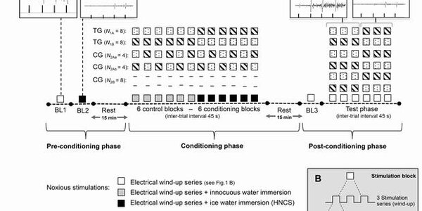Article teaser image
