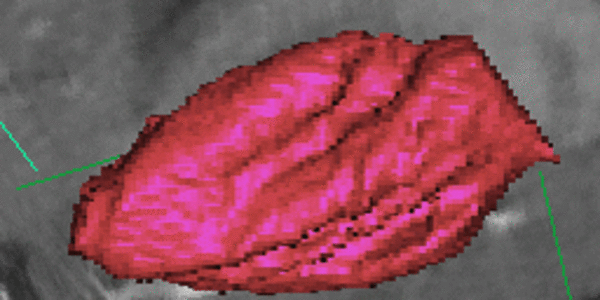 Article teaser image