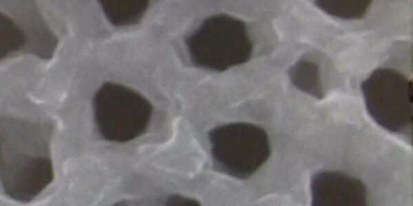 Article teaser image