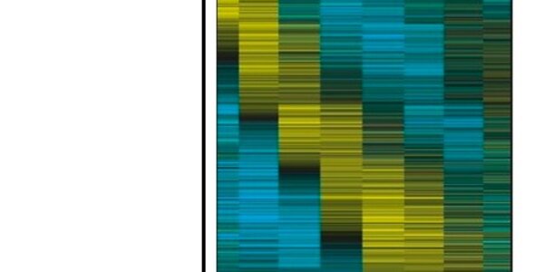 Article teaser image