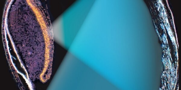 Article teaser image