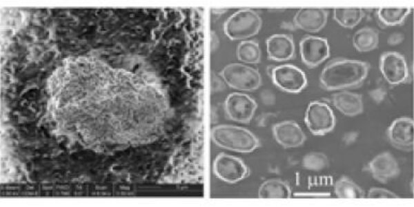 Article teaser image