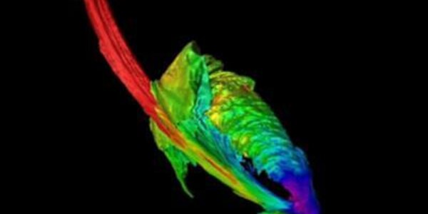 Article teaser image