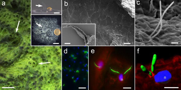 Article teaser image