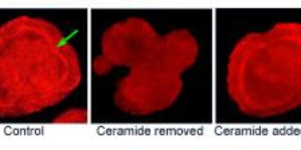 Article teaser image