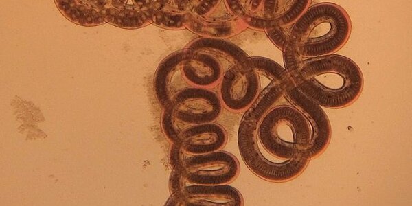 Article teaser image