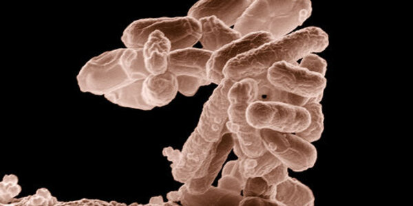 Article teaser image