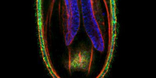 Article teaser image