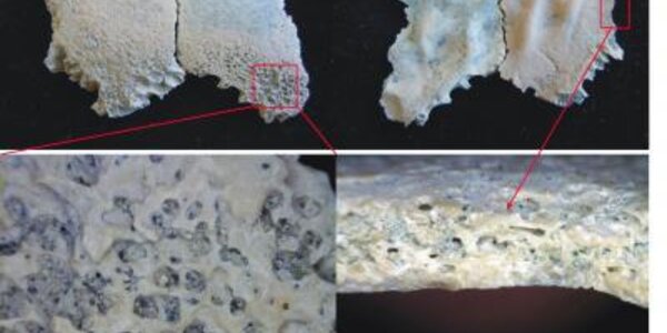 Article teaser image