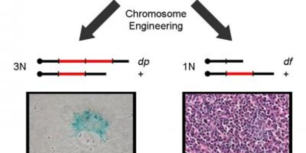 Article teaser image