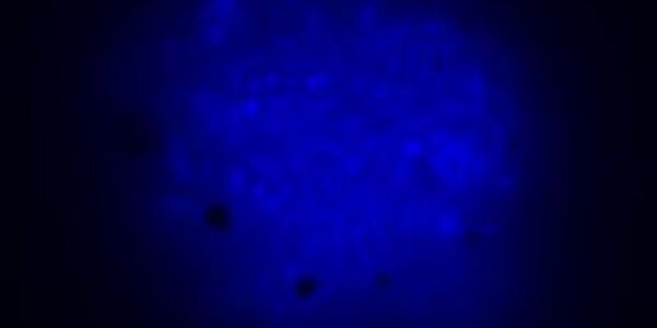 Article teaser image