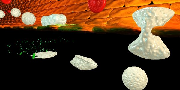 Article teaser image