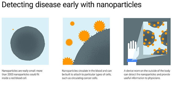 Article teaser image