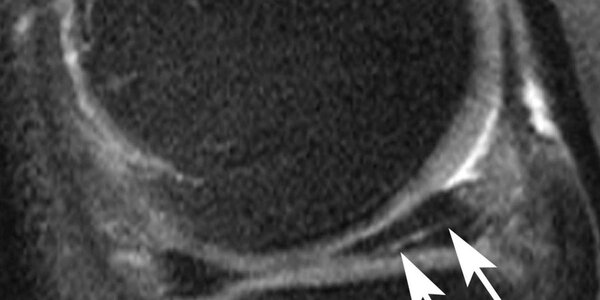 Article teaser image