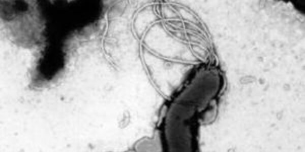 Article teaser image