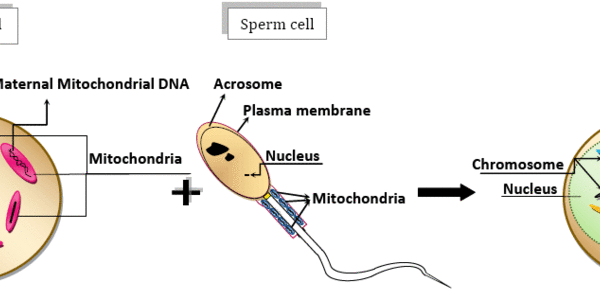 Article teaser image