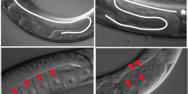 Article teaser image