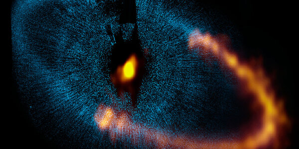 Article teaser image