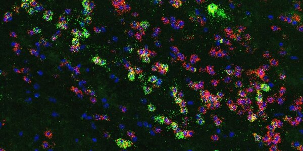 Article teaser image