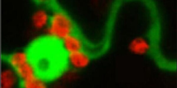 Article teaser image