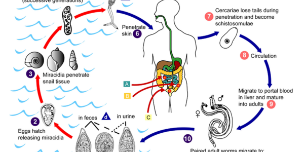 Article teaser image