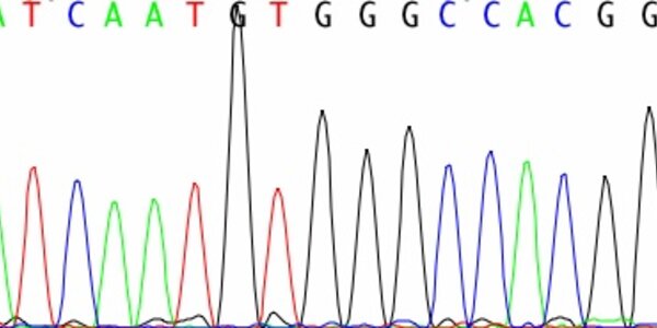 Article teaser image