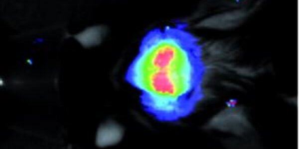 Article teaser image