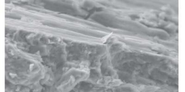 Article teaser image