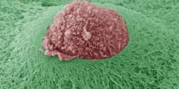 Article teaser image